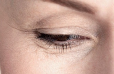 Comment atténuer les rides sous les yeux