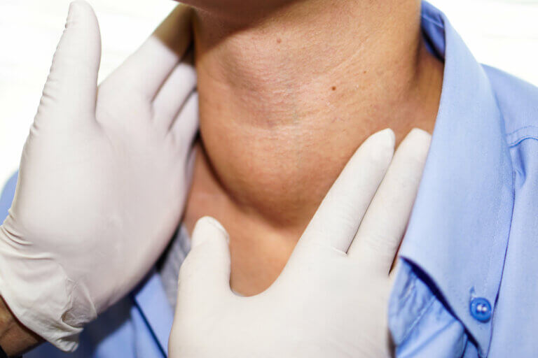 Le goitre : une inflammation de la thyroïde