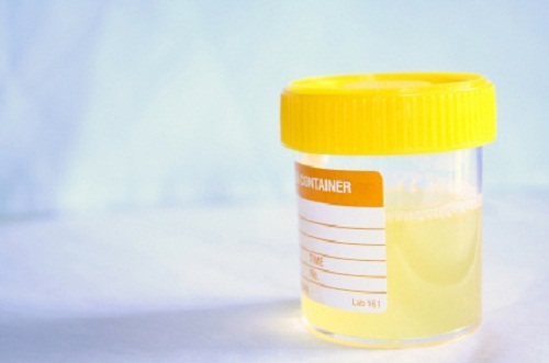 Comment prévenir naturellement les infections urinaires ?