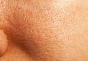 Conseils pour resserrer naturellement les pores