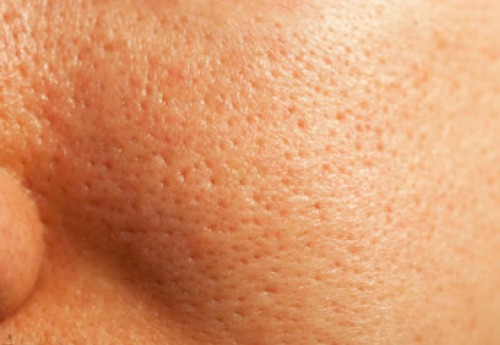 Conseils pour resserrer naturellement les pores