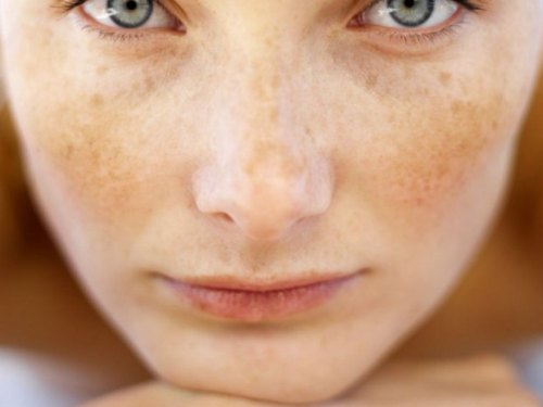 Eliminer les taches.