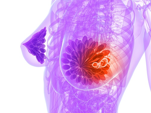 9 aliments qui vous aident à prévenir le cancer du sein