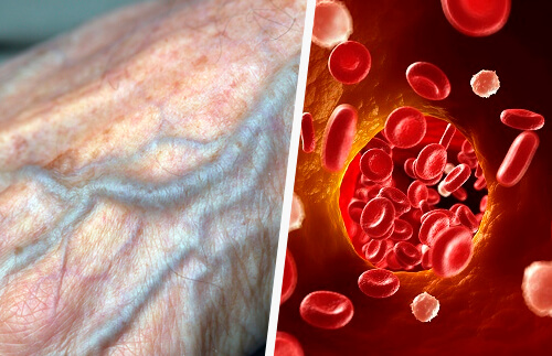 4 conseils pour améliorer la circulation sanguine