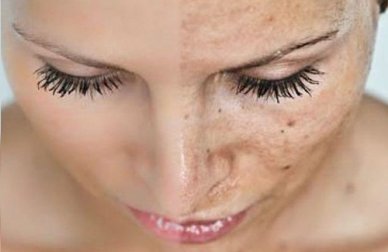 5 causes du vieillissement prématuré