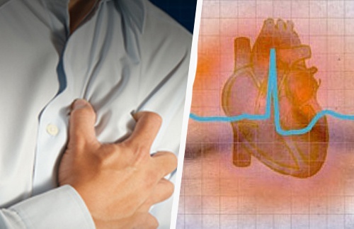 Symptômes et conséquences de l'arythmie cardiaque