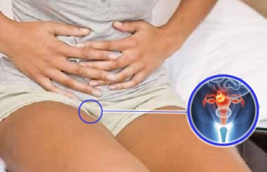 7 signes avant-coureurs du cancer du col de l'utérus