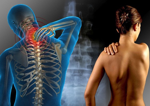 Les points clés pour détecter la fibromyalgie