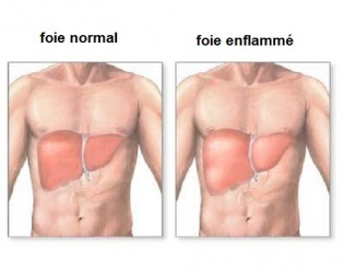 Comment savoir si notre foie est enflammé ?