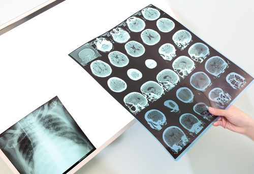 Problèmes suite au manque de sommeil.