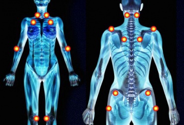 Plantes médicinales pour soulager les symptômes de la fibromyalgie