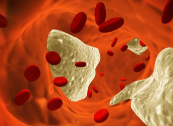 7 mythes sur le cholestérol