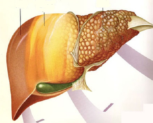 Les meilleurs fruits contre la maladie du foie gras Les meilleurs fruits contre la maladie du foie gras