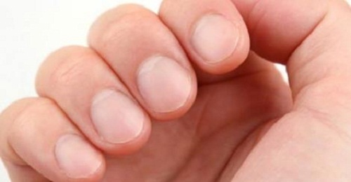 Les ongles et la santé : 8 choses qu'ils vous révèlent