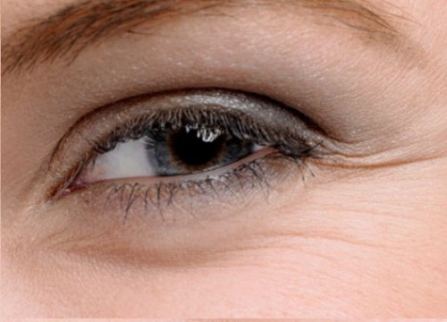 Le clignement des yeux est efficace contre les poches sous les yeux.