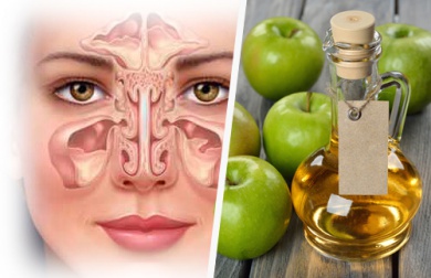 Remèdes maison pour la congestion des sinus