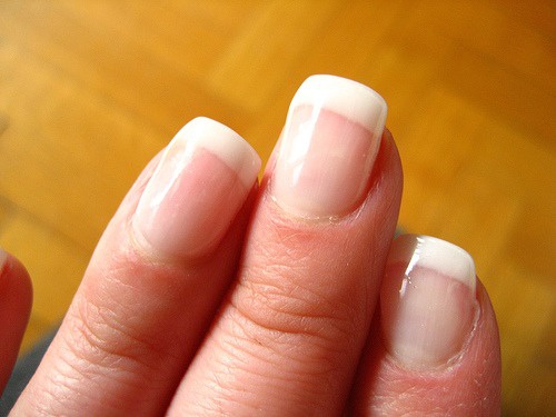 Les ongles et la santé : les ongles décolorés sont un signe de dysfonctionnement.