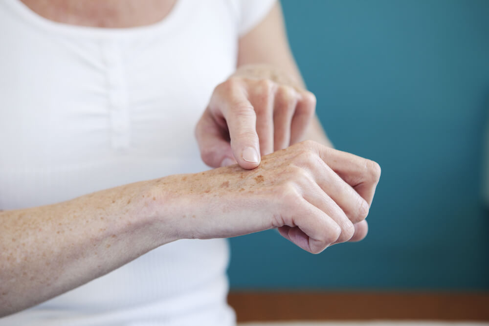 Taches sur les mains : comment les atténuer ? - Améliore ta Santé