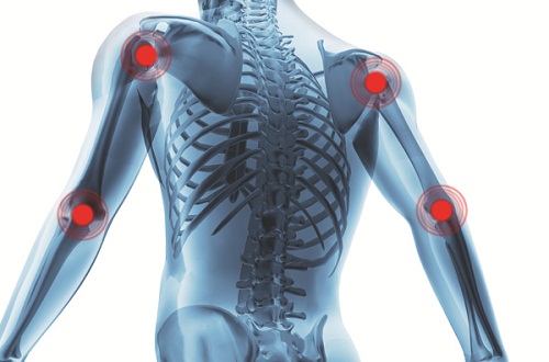 douleurs à l épaule : ostéo-arthrite et douleur articulaire