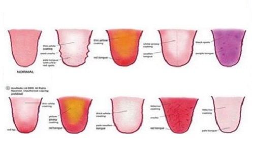 La Couleur De La Langue Revele Votre Etat De Sante Ameliore Ta Sante