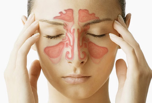 l'acupression pour combattre la congestion nasale