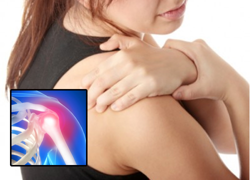 Comment prévenir et traiter les douleurs à l'épaule