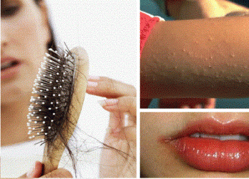 Les signes d'une carence en vitamines