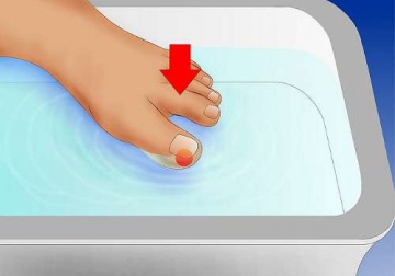 Comment bien traiter les ongles incarnés