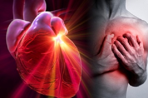 Savoir reconnaître les différences entre un infarctus, un arrêt cardiaque et un ictus
