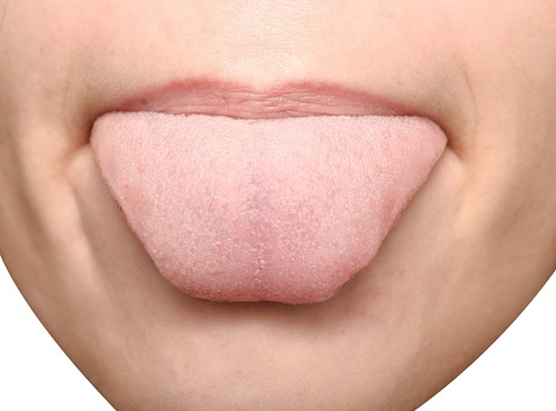 La couleur de la langue est blanche indique des problèmes digestifs