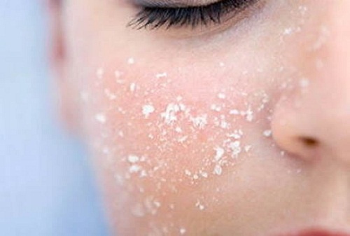 Sel pour la peau pour traiter les pores dilatées 