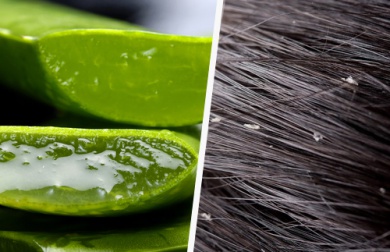 Remèdes simples et efficaces pour combattre les pellicules