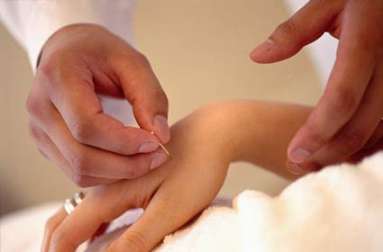 Le point Ling Gu, un point d'acupuncture pour la sciatique