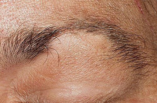 Traitement contre l’alopécie des sourcils et des cils