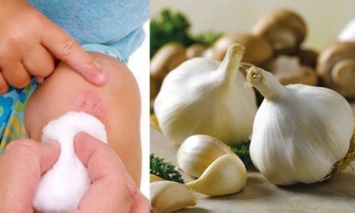 Les 8 meilleurs antiseptiques naturels pour la peau