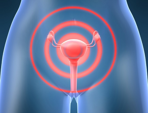 Que sont les fibromes, et comment les traiter ? Que sont les fibromes, et comment les traiter ?