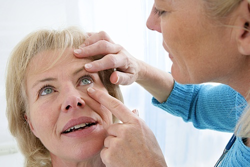 Causes de la vision floue : la cataracte