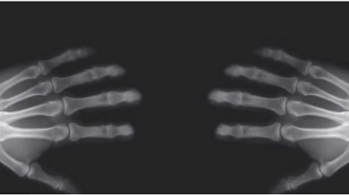 Ce qui arrive quand vous vous faites craquer les doigts