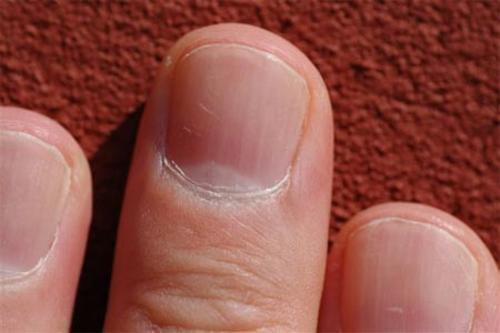 Saviez-vous que vos ongles peuvent en dire beaucoup sur votre santé ?