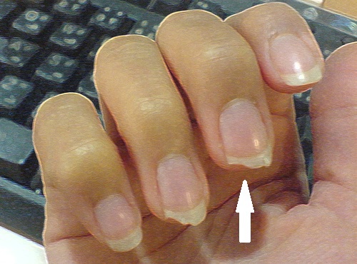 Qu'est-ce que se ronger les ongles dit de votre personnalité : mimétisme