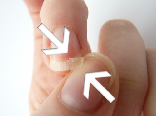 Fragilité de vos ongles.