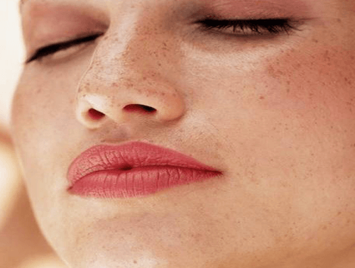 Comment traiter la peau dépigmentée ou tâchée