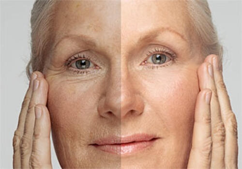 Découvrez l’âge de votre peau et les façons de la rajeunir