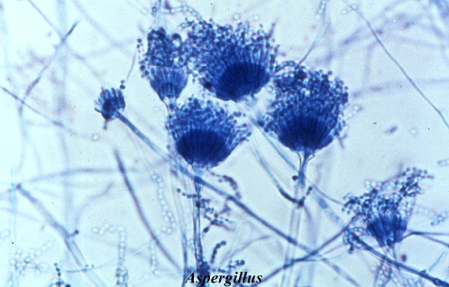 moisissure-Aspergillus