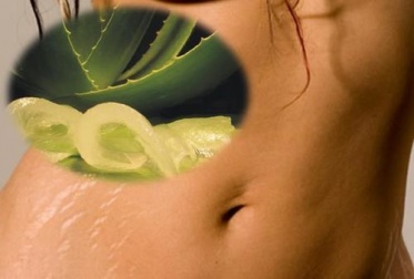 Remèdes naturels pour atténuer les vergetures