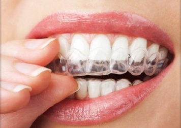 4 techniques pour ne plus souffrir de bruxisme