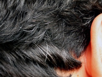 Remèdes contre les cheveux blancs prématurés