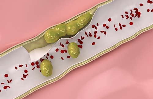 3 infusions médicinales pour renforcer et nettoyer ses artères et ses veines