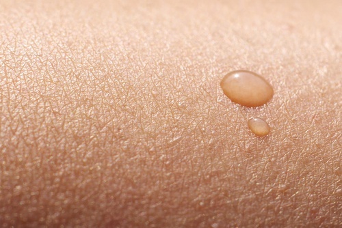 Peau-seche-500x334