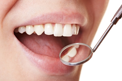 Les 5 remèdes naturels les plus efficaces pour se débarrasser de la plaque dentaire